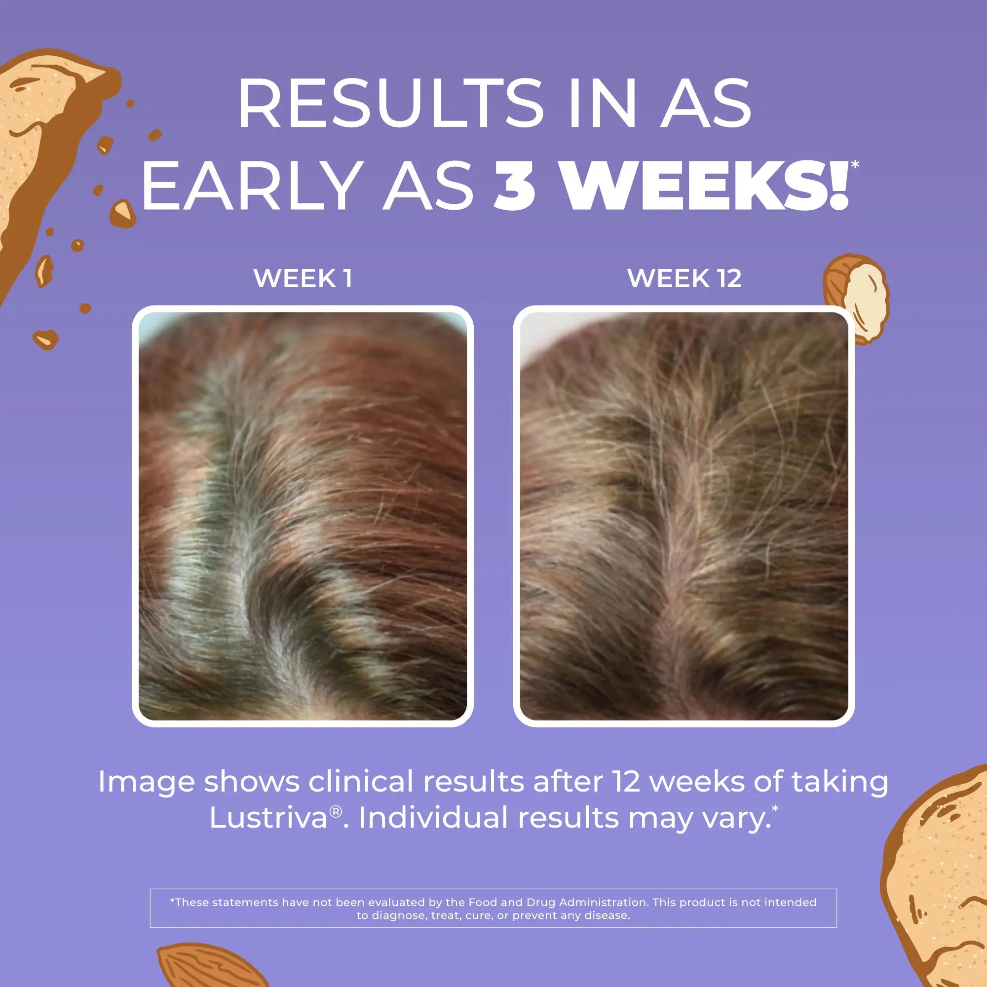 Maryruth'S Hair Growth Max Liposomal - Lustriva + Biotin 10000Mcg + Pumpkin Seed Oil - Thicker Hair - Improve Wrinkles & Fine Lines - 15.22 Fl Oz